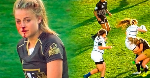 Esta chica se rompió la nariz jugando Rugby, se levantó y siguió como si nada pasara