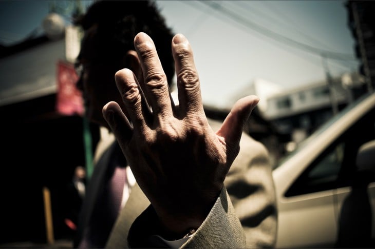 mano de miemro yakuza con cuatro dedos