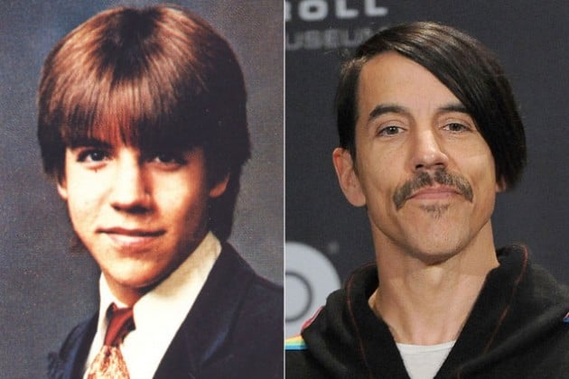 Anthony Kiedis antes y después