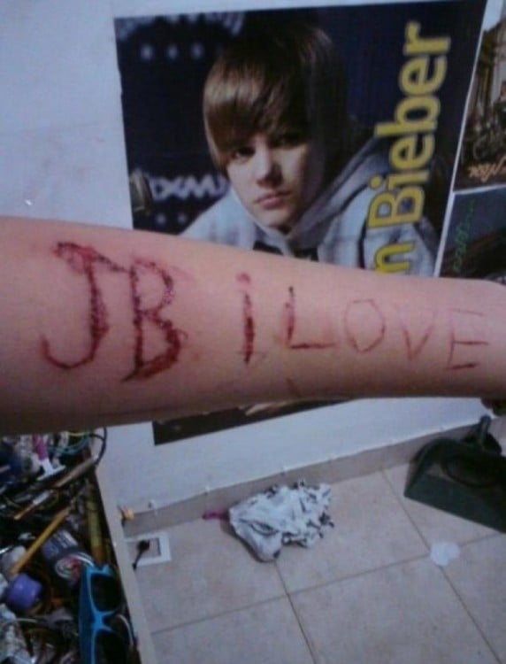 brazo cortado Justin Bieber