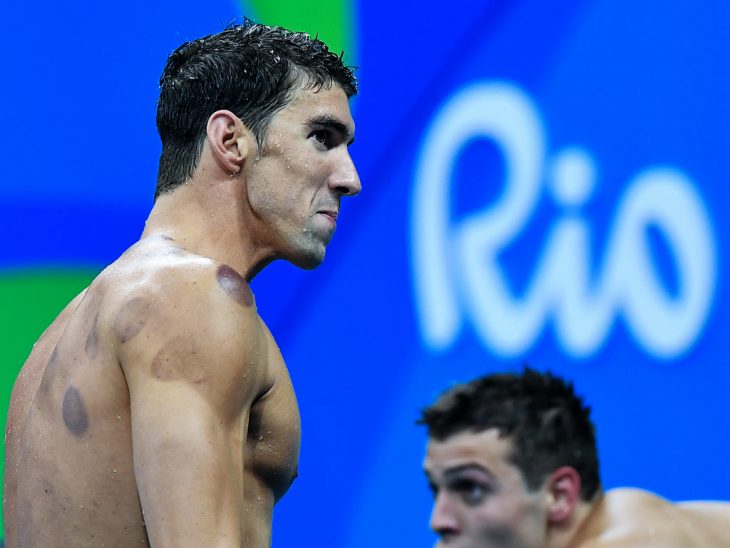 phelps círculos rojos en la espalda