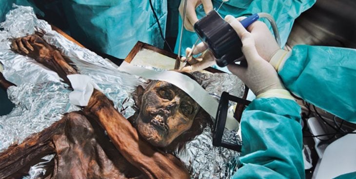 ötzi investigación médicos