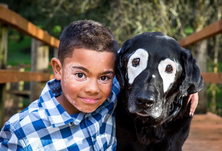 niño vitiligo y perro