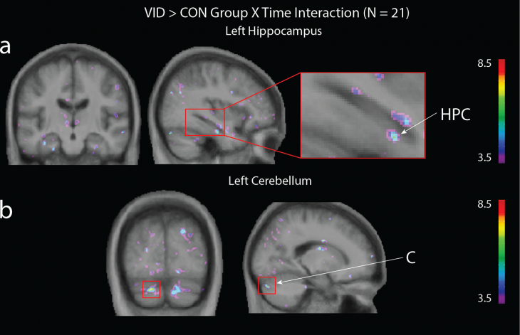 cerebro estudio