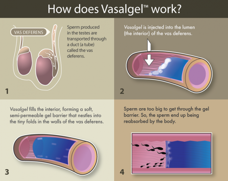 vasalgel