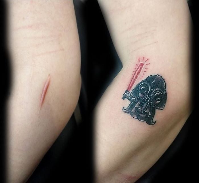 Tatuajes en cicatrices