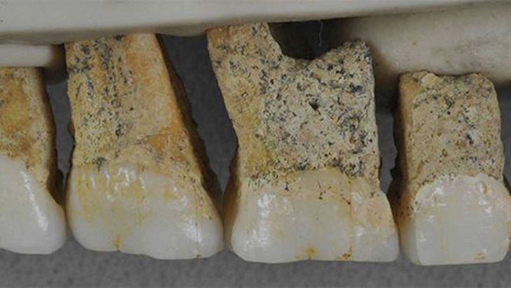 Dientes de Homo luzonensis