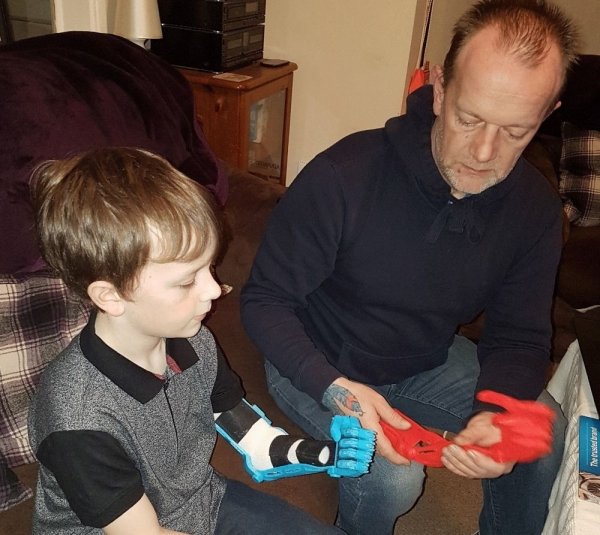 papá imprime prótesis 3D para brazo de hijo 