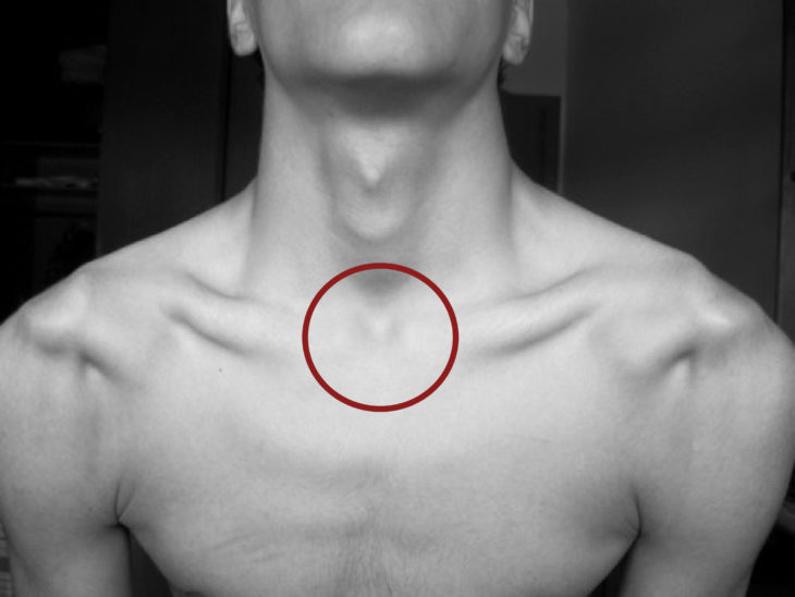 claviculas