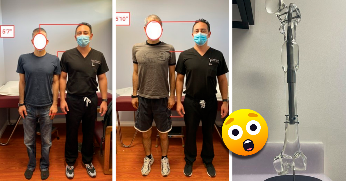 Doctor promete hacerte más alto con una compleja cirugía Doctor promete hacerte más alto con una compleja cirugía