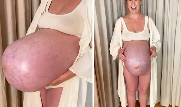 Mujer embarazada de trillizos