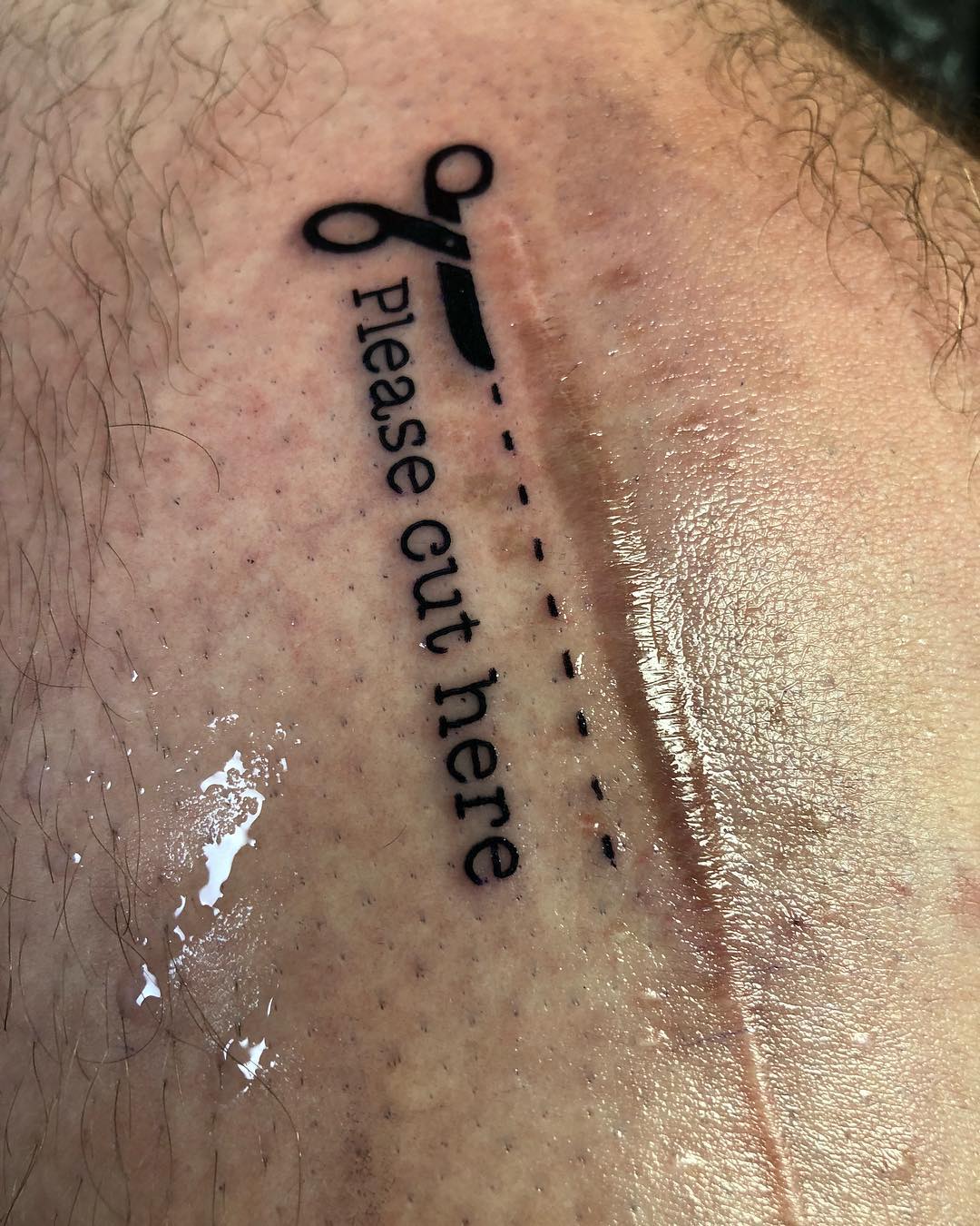 20 tatuajes que integraron cicatrices y marcas de nacimiento