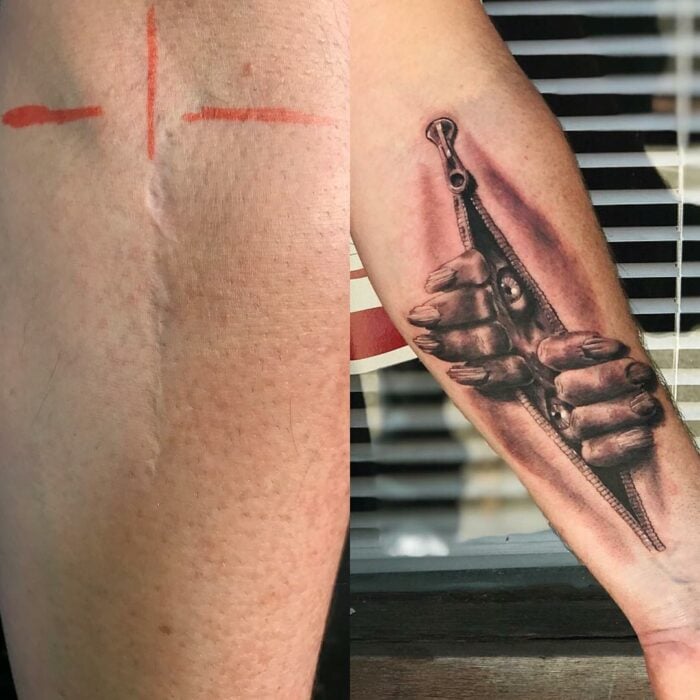 tatuaje de cremallera con creatura tratando de salir de la piel cicatriz