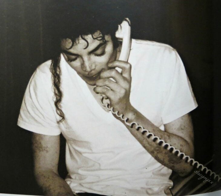 El vitiligo de Michael Jackson