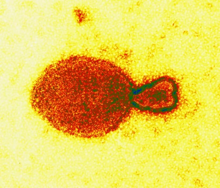 Henipavirus