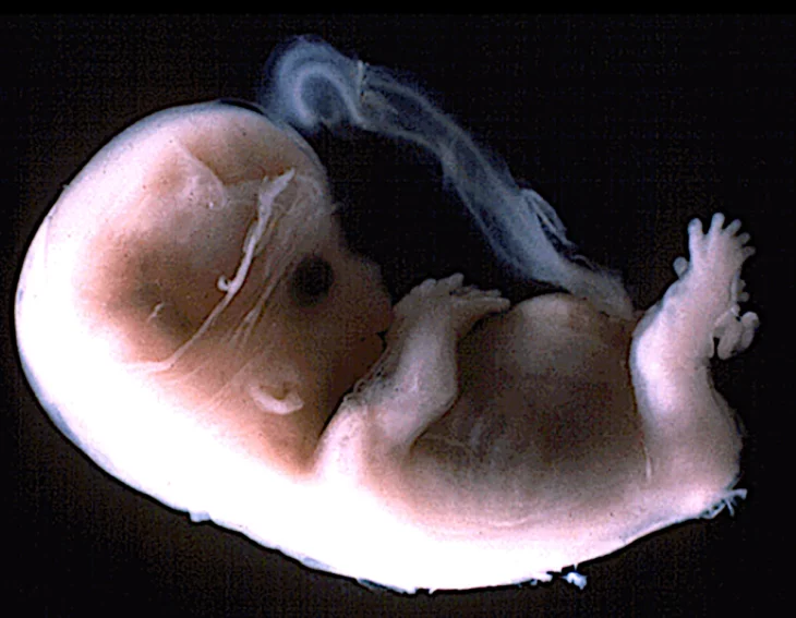 feto humano