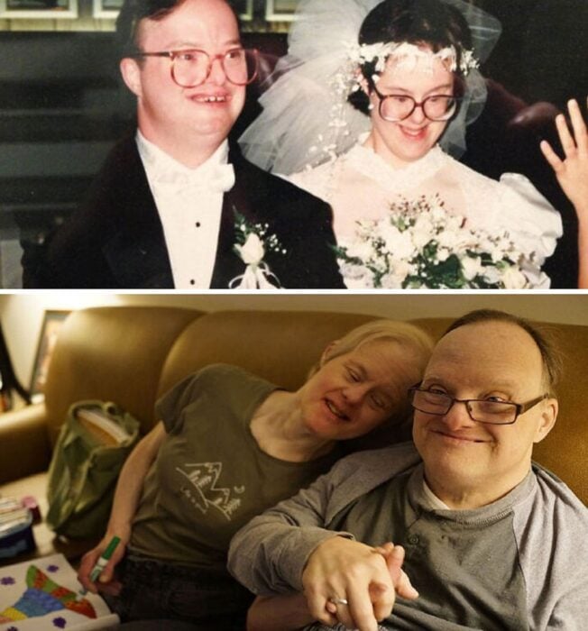 Casados a pesar del síndrome de Down