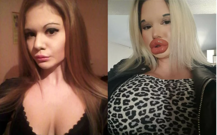 Andrea antes y después