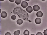 Bacteria Gram negativa como la pasteurella multocida