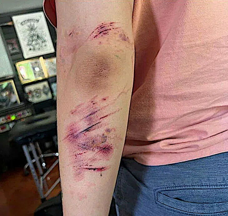 Tatuaje tattoo que parece raspones alrededor de un codo