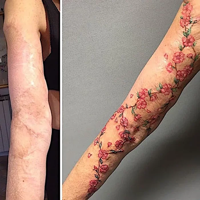 Tattoo enredadera arreglo floral sobre cicatriz