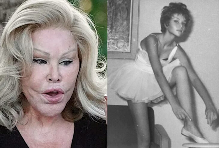 Jocelyn WIldenstein antes y después clases de ballet a los 15 años