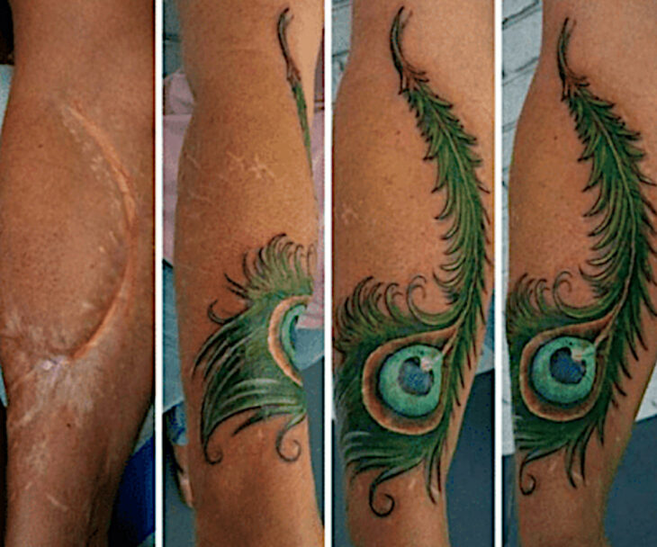 Tatuaje cicatriz pluma de pavorreal