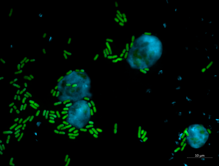 Amebas atacadas por bacterias