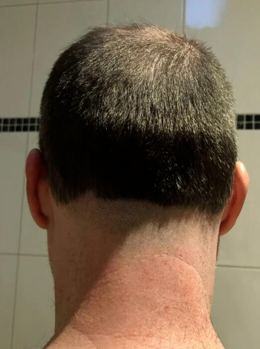 Mal corte de pelo