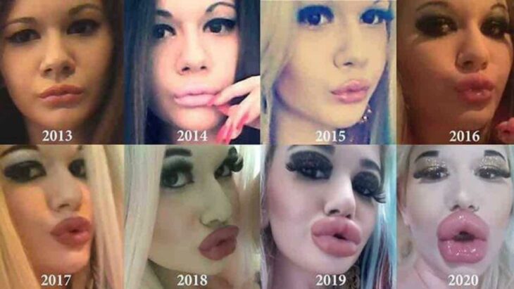 Andrea Ivanova la mujer con los labios más grandes del mundo