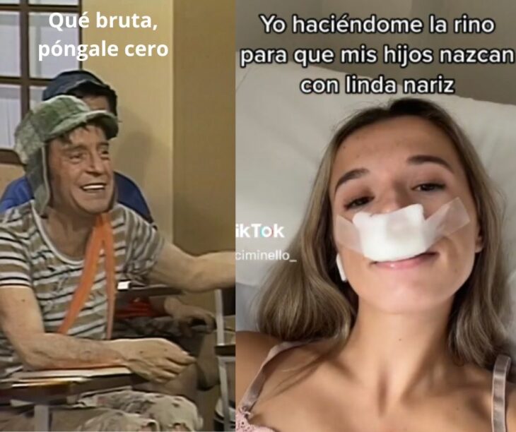 Fiore Ciminello afirma que sus hijos tendrán nariz bonita porque se hizo la rinoplastia 